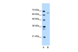 Aviva Systems Biology Corp IVL Antibody - N-terminal region (ARP48675_P050)