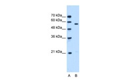 Aviva Systems Biology Corp STK3 Antibody - N-terminal region (ARP48700_P050)