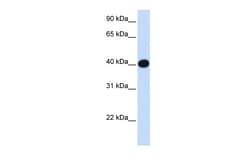 Aviva Systems Biology Corp LIAS Antibody - N-terminal region (ARP48716_P050)