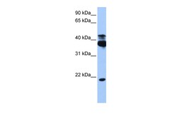 Aviva Systems Biology Corp STK38 Antibody - C-terminal region (ARP48727_P050)