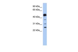 Aviva Systems Biology Corp PGDS Antibody - N-terminal region (ARP48763_P050)