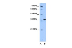 Aviva Systems Biology Corp AASDHPPT Antibody - C-terminal region (ARP48777_P050)