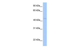 Aviva Systems Biology Corp LIPT1 Antibody - N-terminal region (ARP48784_P050)