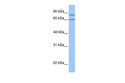 Aviva Systems Biology Corp OXCT2 Antibody - middle region (ARP48886_P050)