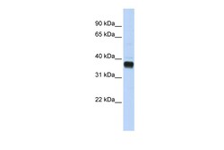 Aviva Systems Biology Corp NUDT18 Antibody - C-terminal region (ARP48922_P050)