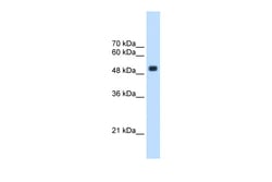 Aviva Systems Biology Corp CXorf34 Antibody - middle region (ARP48928_T100)