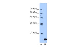 Aviva Systems Biology Corp NAT13 Antibody - C-terminal region (ARP48934_T100)