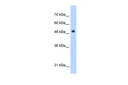 Aviva Systems Biology Corp PNPLA3 Antibody - C-terminal region (ARP48936_P050)