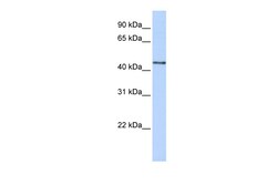 Aviva Systems Biology Corp B3GNT4 Antibody - N-terminal region (ARP48944_P050)