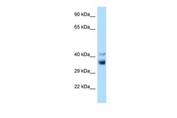 Aviva Systems Biology Corp Nek7 Antibody - C-terminal region (ARP49000_P050)