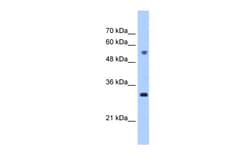 Aviva Systems Biology Corp TTC5 Antibody - C-terminal region (ARP49004_P050)