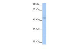 Aviva Systems Biology Corp PNPLA5 Antibody - C-terminal region (ARP49011_P050)