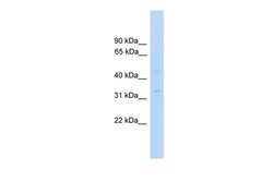 Aviva Systems Biology Corp MTFMT Antibody - C-terminal region (ARP49013_P050)