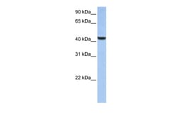 Aviva Systems Biology Corp B3GNT7 Antibody - N-terminal region (ARP49027_P050)