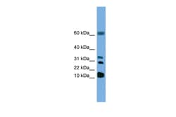 Aviva Systems Biology Corp LTC4S Antibody - N-terminal region (ARP49035_T100)