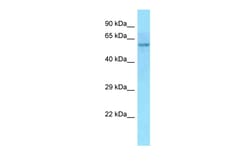 Aviva Systems Biology Corp POC5 Antibody - C-terminal region (ARP49057_P050)