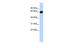 Aviva Systems Biology Corp B3GALNT2 Antibody - middle region (ARP49060_P050)