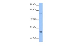 Aviva Systems Biology Corp METTL7B Antibody - middle region (ARP49069_P050)