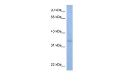 Aviva Systems Biology Corp ST6GALNAC3 Antibody - C-terminal region (ARP49075_P050)