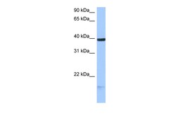 Aviva Systems Biology Corp HS3ST5 Antibody - C-terminal region (ARP49083_P050)