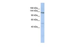 Aviva Systems Biology Corp CHSY-2 Antibody - N-terminal region (ARP49126_P050)