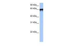 Aviva Systems Biology Corp TGM6 Antibody - middle region (ARP49194_P050)