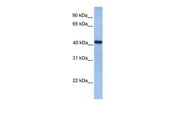 Aviva Systems Biology Corp GMPPA Antibody - N-terminal region (ARP49209_P050)