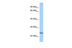Aviva Systems Biology Corp EEF1AKMT2 Antibody - middle region (ARP49216_P050)