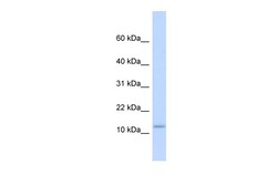 Aviva Systems Biology Corp C9orf46 Antibody - middle region (ARP49314_P050)