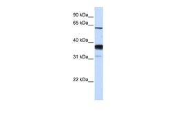 Aviva Systems Biology Corp SMPD3 Antibody - middle region (ARP49331_P050)