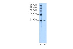 Aviva Systems Biology Corp RAB5IF Antibody - N-terminal region (ARP49339_T100)