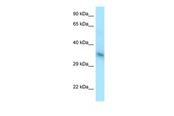 Aviva Systems Biology Corp YIPF1 Antibody - C-terminal region (ARP49421_P050)