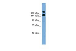 Aviva Systems Biology Corp UGCGL1 Antibody - middle region (ARP49467_P050)