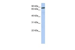 Aviva Systems Biology Corp SEMA4B Antibody - N-terminal region (ARP49485_P050)