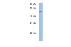 Aviva Systems Biology Corp FAM20C Antibody - middle region (ARP49489_P050)