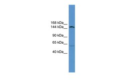 Aviva Systems Biology Corp Atp10d Antibody - middle region (ARP49515_P050)