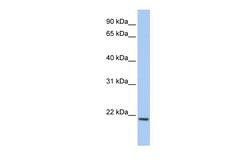 Aviva Systems Biology Corp IL22 Antibody - C-terminal region (ARP49523_P050)