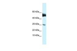 Aviva Systems Biology Corp Amhr2 Antibody - N-terminal region (ARP49527_P050)
