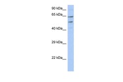 Aviva Systems Biology Corp TMCC3 Antibody - N-terminal region (ARP49543_P050)