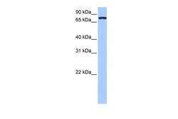 Aviva Systems Biology Corp NLGN4X Antibody - middle region (ARP49557_P050)