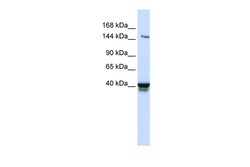Aviva Systems Biology Corp IGSF9 Antibody - N-terminal region (ARP49567_P050)