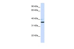 Aviva Systems Biology Corp B3GALT1 Antibody - N-terminal region (ARP49606_P050)