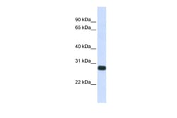 Aviva Systems Biology Corp SPINT2 Antibody - middle region (ARP49615_P050)