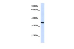 Aviva Systems Biology Corp RTN1 Antibody - N-terminal region (ARP49622_P050)