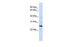 Aviva Systems Biology Corp RTN1 Antibody - middle region (ARP49623_P050)