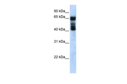 Aviva Systems Biology Corp UGT2B4 Antibody - N-terminal region (ARP49624_P050)