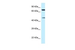 Aviva Systems Biology Corp CDH22 Antibody - N-terminal region (ARP49648_T100)
