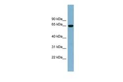 Aviva Systems Biology Corp IL22RA1 Antibody - middle region (ARP49650_P050)