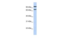 Aviva Systems Biology Corp FAM38B Antibody - middle region (ARP49683_P050)