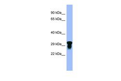 Aviva Systems Biology Corp VSIR Antibody - N-terminal region (ARP49699_P050)